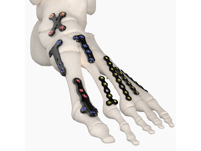 Locking Systems copy